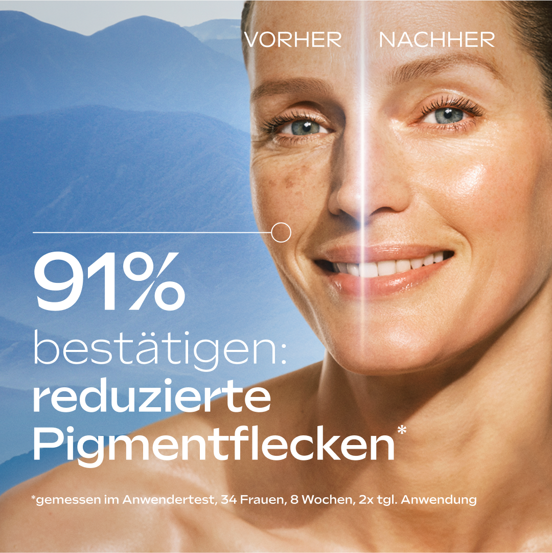 WELEDA Gesichtsserum »ANTI-PIGMENTFLECKEN BRIGHT SERUM« weniger Pigmentflecken, mehr Kollagen