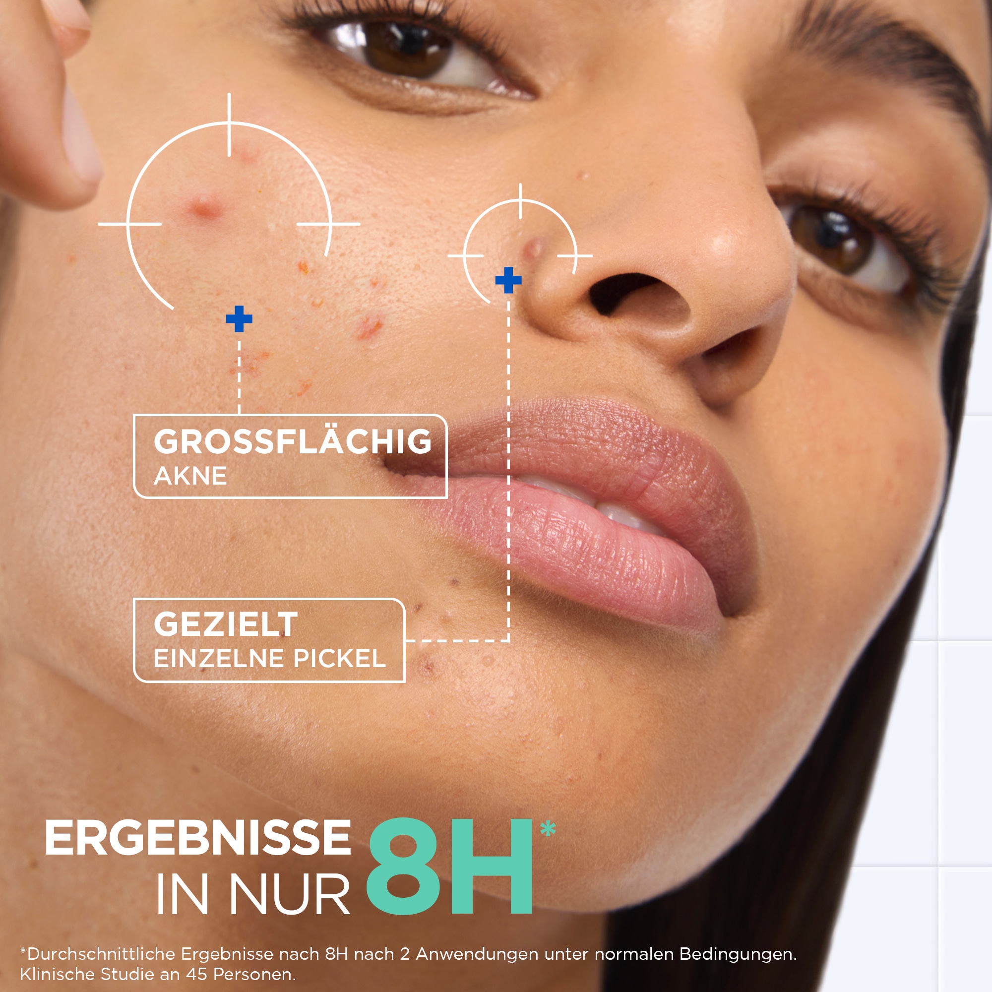 Mixa Gesichts-Reinigungscreme »MIXA KONZENTRIERTE ANTI-PICKEL PASTE« mit Niacinamid