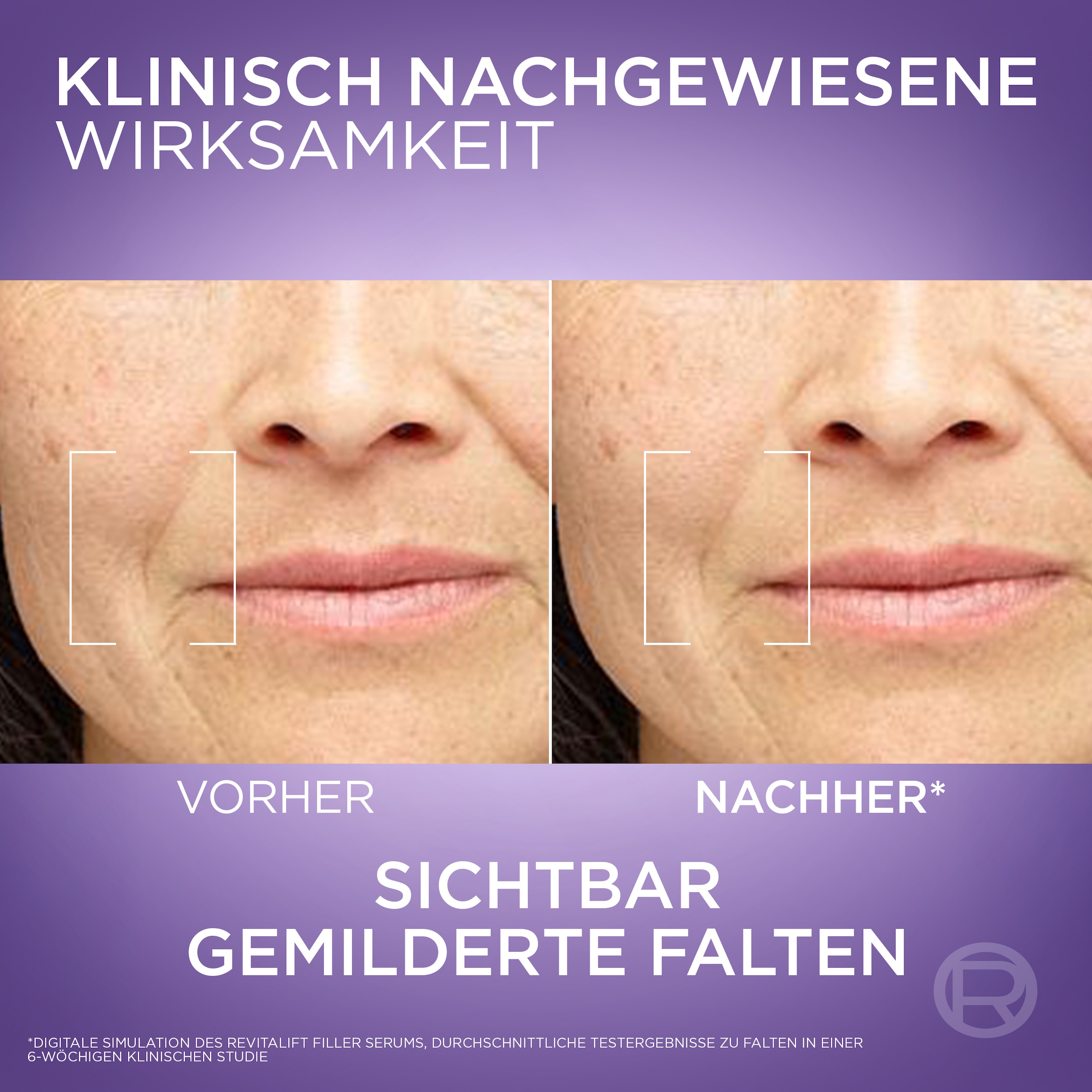 L'ORÉAL PARIS Gesichtsserum »REVITALIFT FILLER ANTI-FALTEN SERUM« mindert Falten, feutigkeitsspendend, mit Pipette