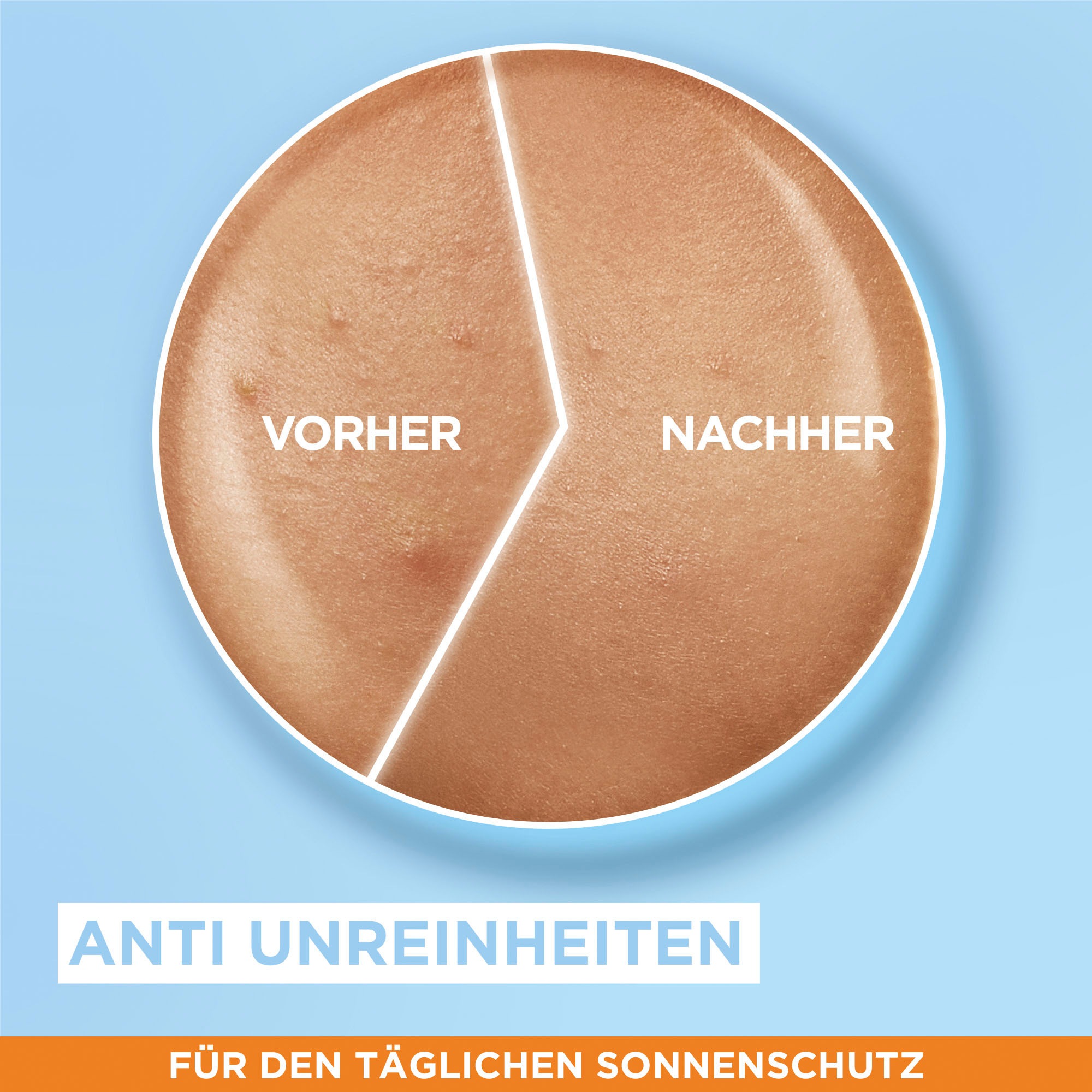 GARNIER Sonnenschutzfluid »Ambre Solaire Sensitive expert+«, mit Hyaluronsäure LSF 50