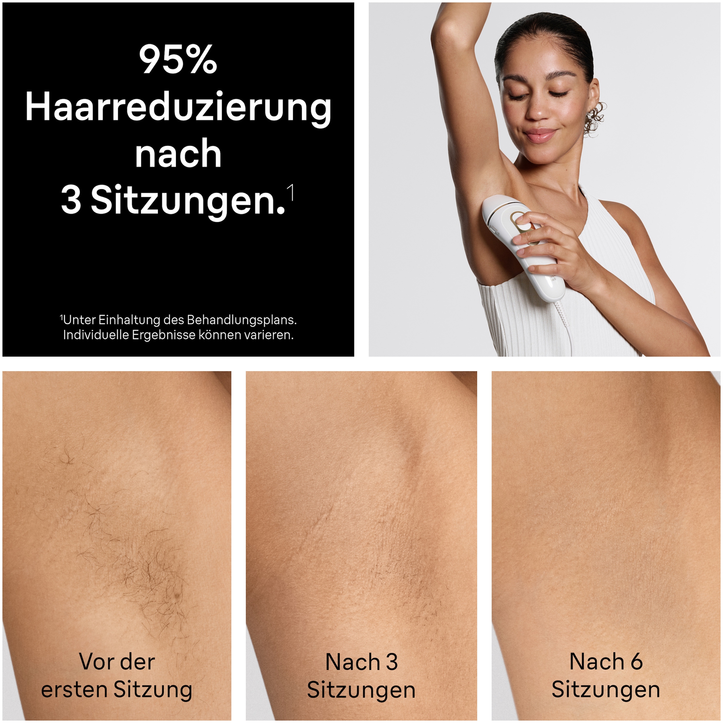 Braun IPL-Haarentferner »Silk-expert Pro IPL PL5412« 400.000 Lichtimpulse dauerhafte Haarreduktion, Tasche, Mini-Gesichtsrasierer, 4 Aufsätze