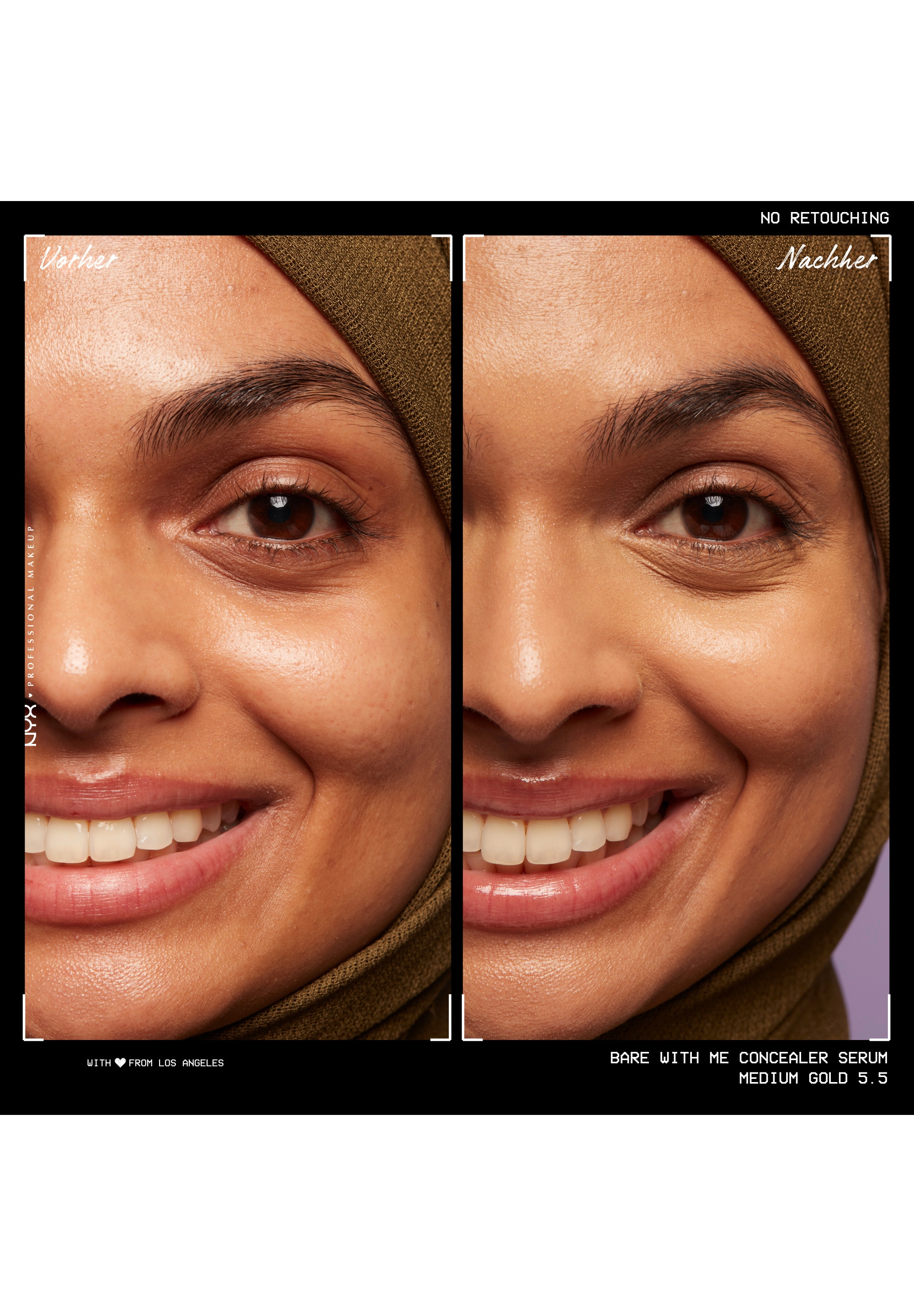 NYX PROFESSIONAL MAKEUP Concealer »Bare With Me Concealer Serum« mittlere Deckkraft, kaschiert, rote oder entzündete Hautstellen