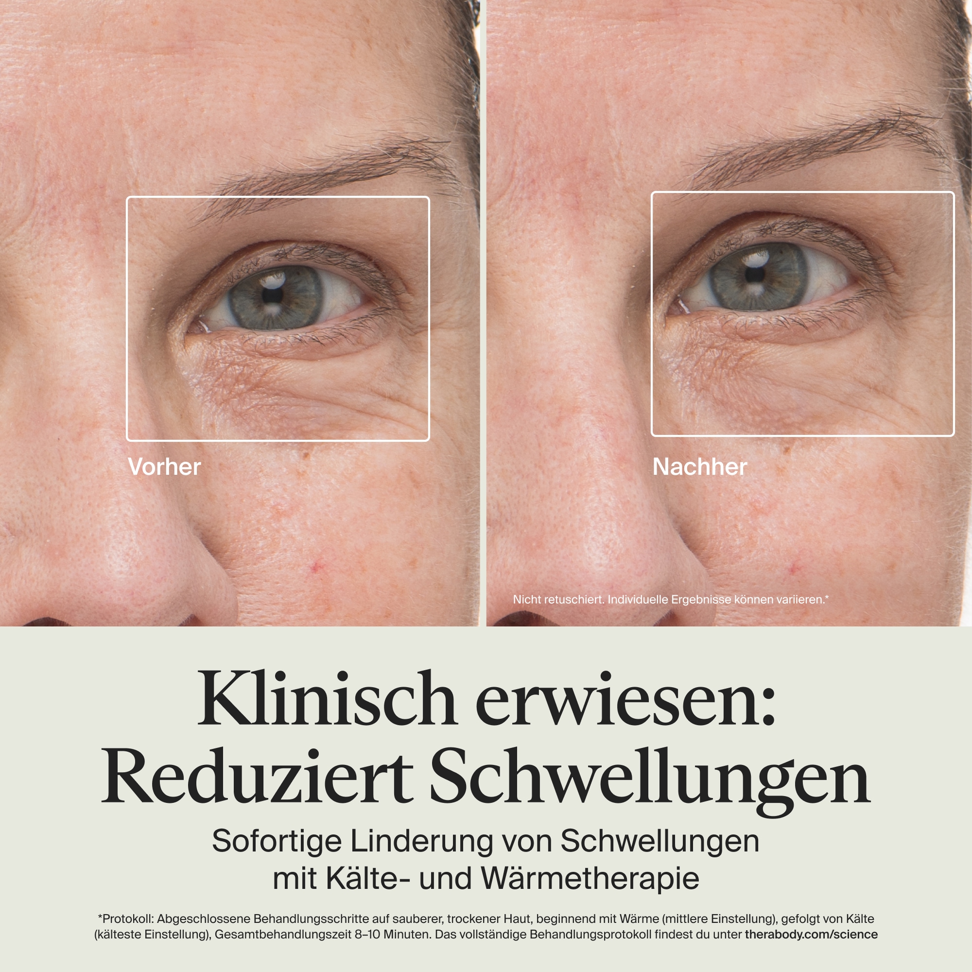 Therabody Anti-Aging-Gerät »Theraface Depuffing Wand Kälte- und Wärmebehandlungen für das Gesicht« Verbessert die Strahlkraft, reduziert Augenringe und Schwellungen