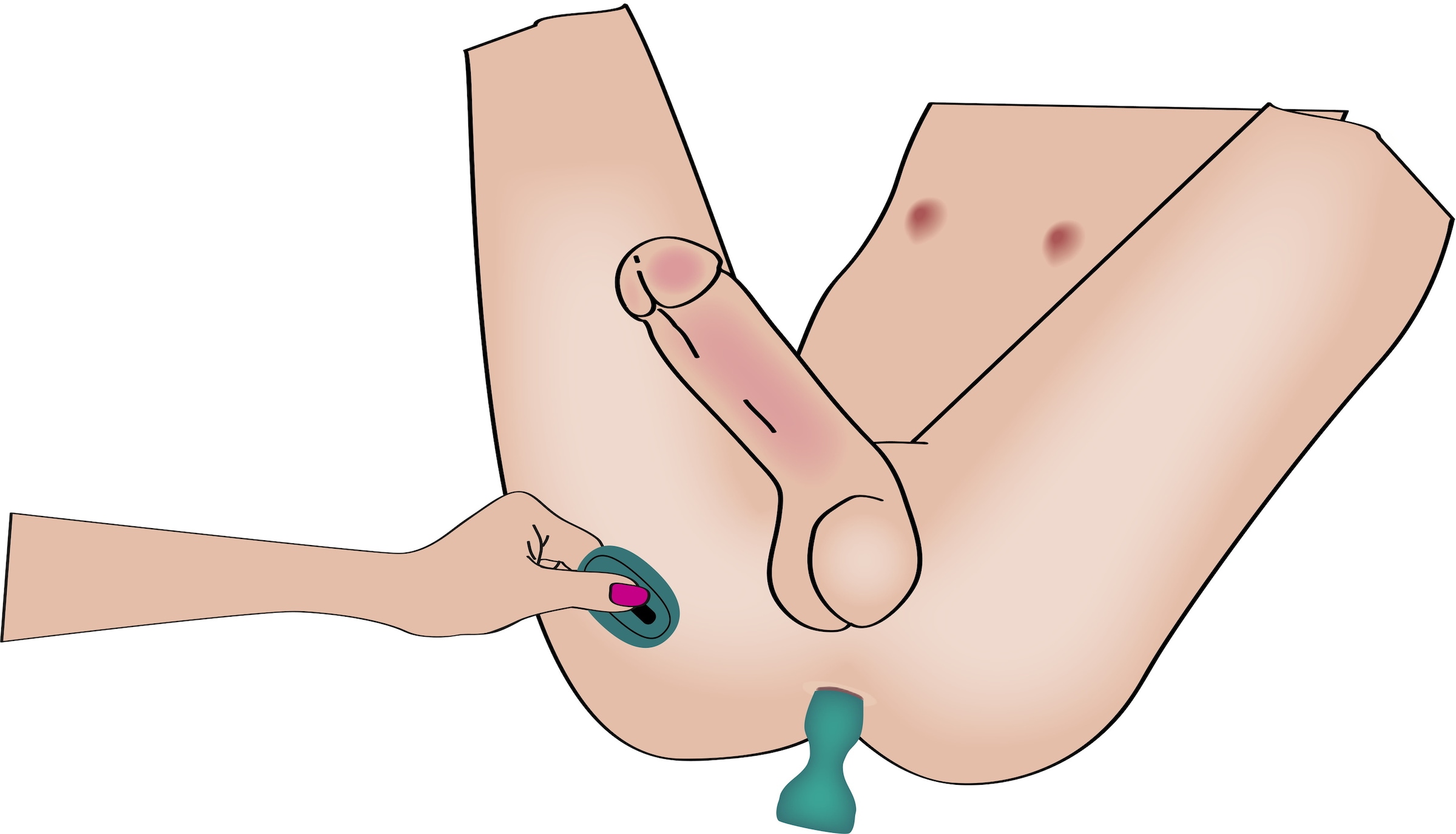 coup!es choice Vibrator »Paartoy-Set RC Mini Vibrator with 4 Attachments«