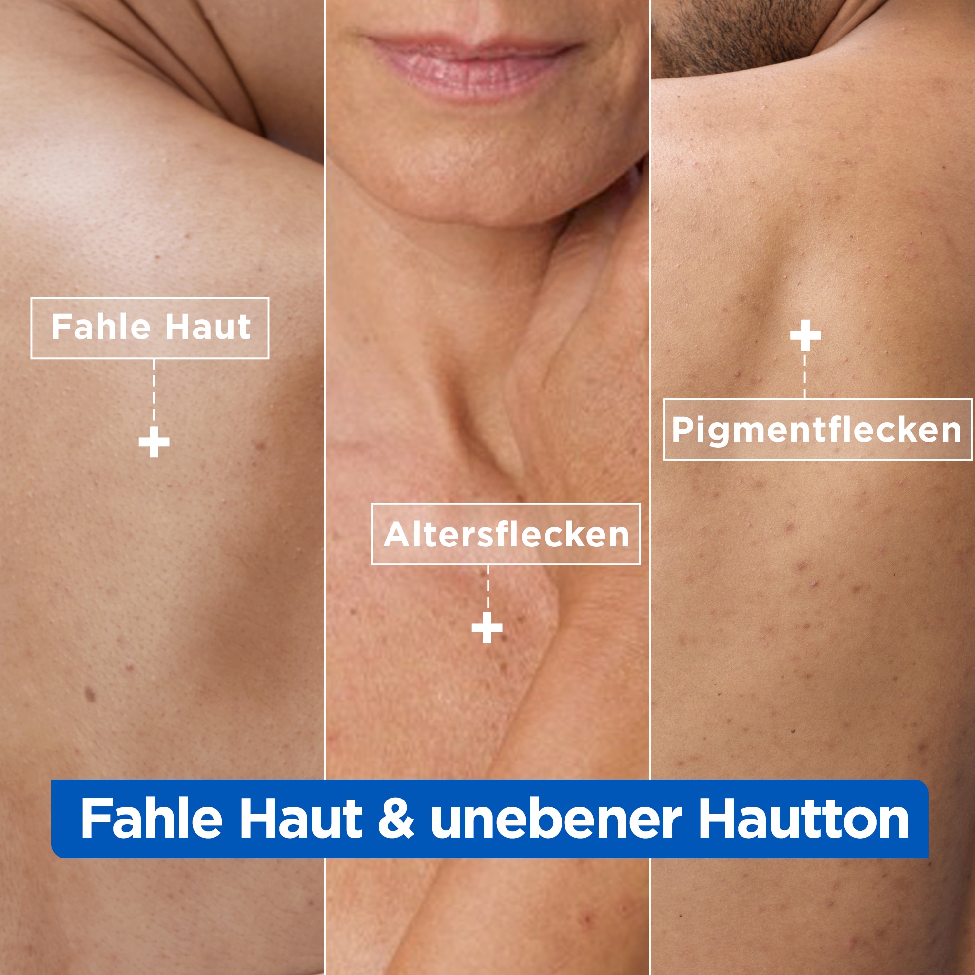 Mixa Körpermilch »Mixa Niacinamide Bright Creme« Mildert sonnenbedingte Pigmentflecken, versorgt trockene Haut.