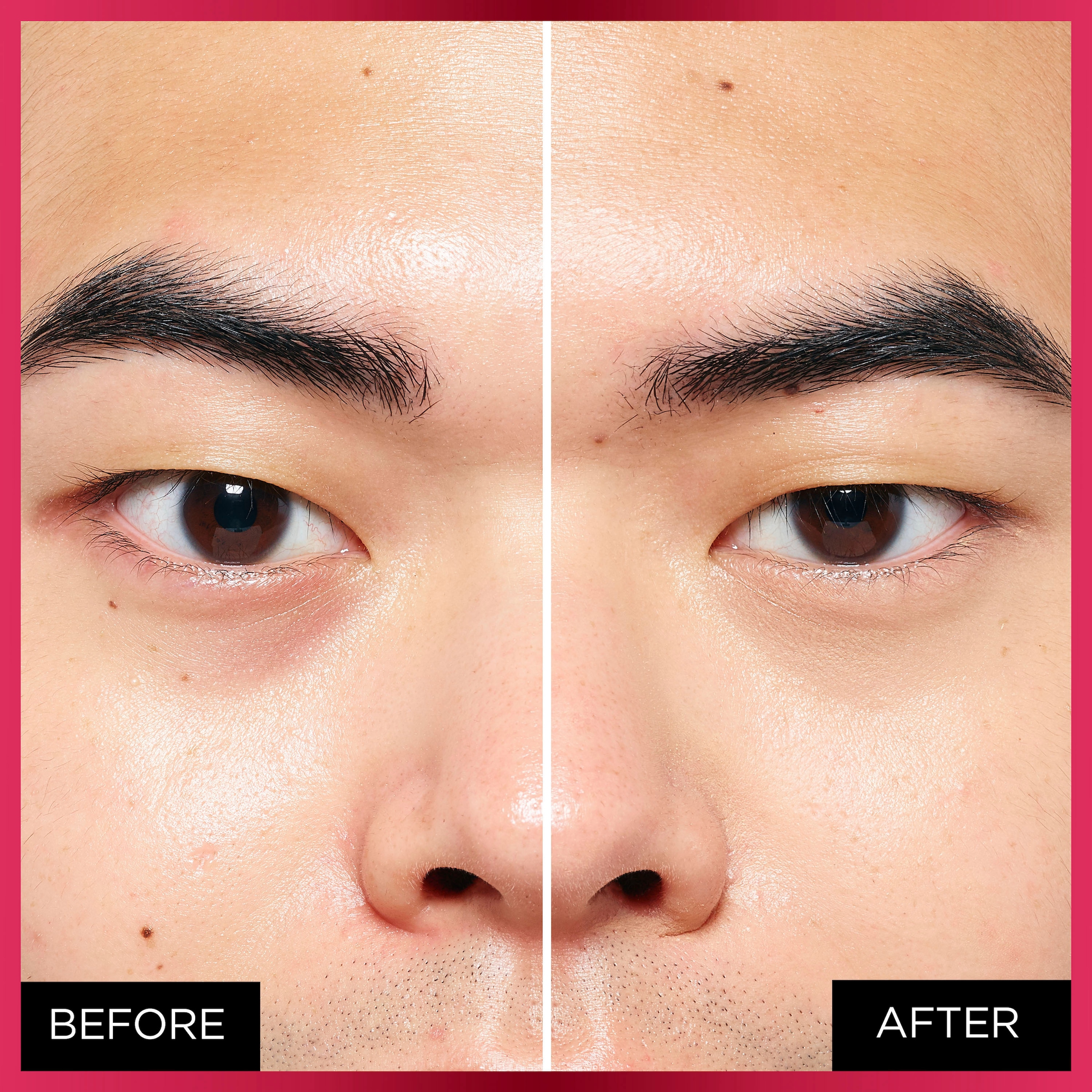 L'ORÉAL PARIS Concealer »Infaillible More Than Concealer« mit hoher Deckkraft