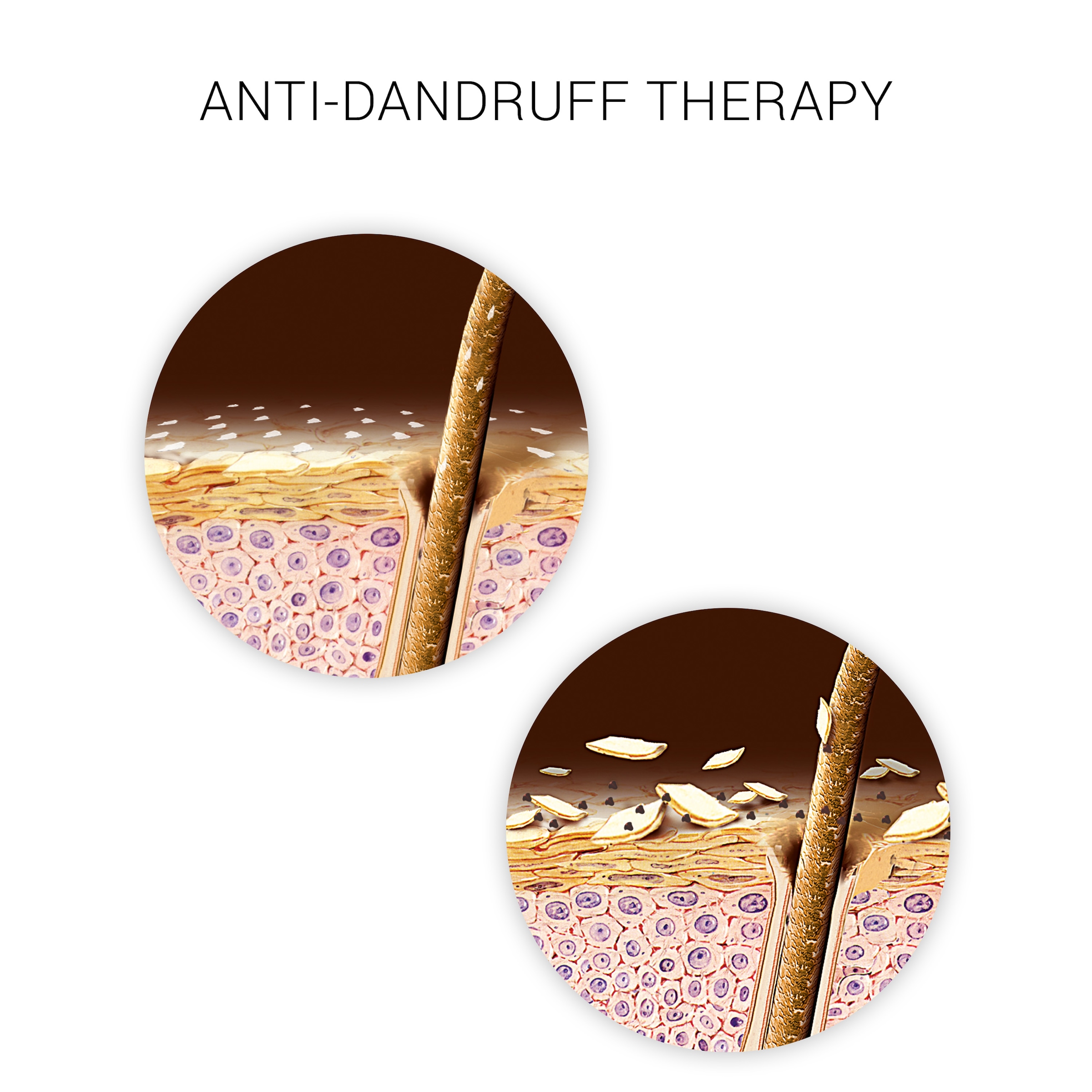 Wella SP Haarshampoo »Clear Scalp Shampeeling« tiefenwirkende Reinigung, gegen Schuppen, hilft bei Juckreiz