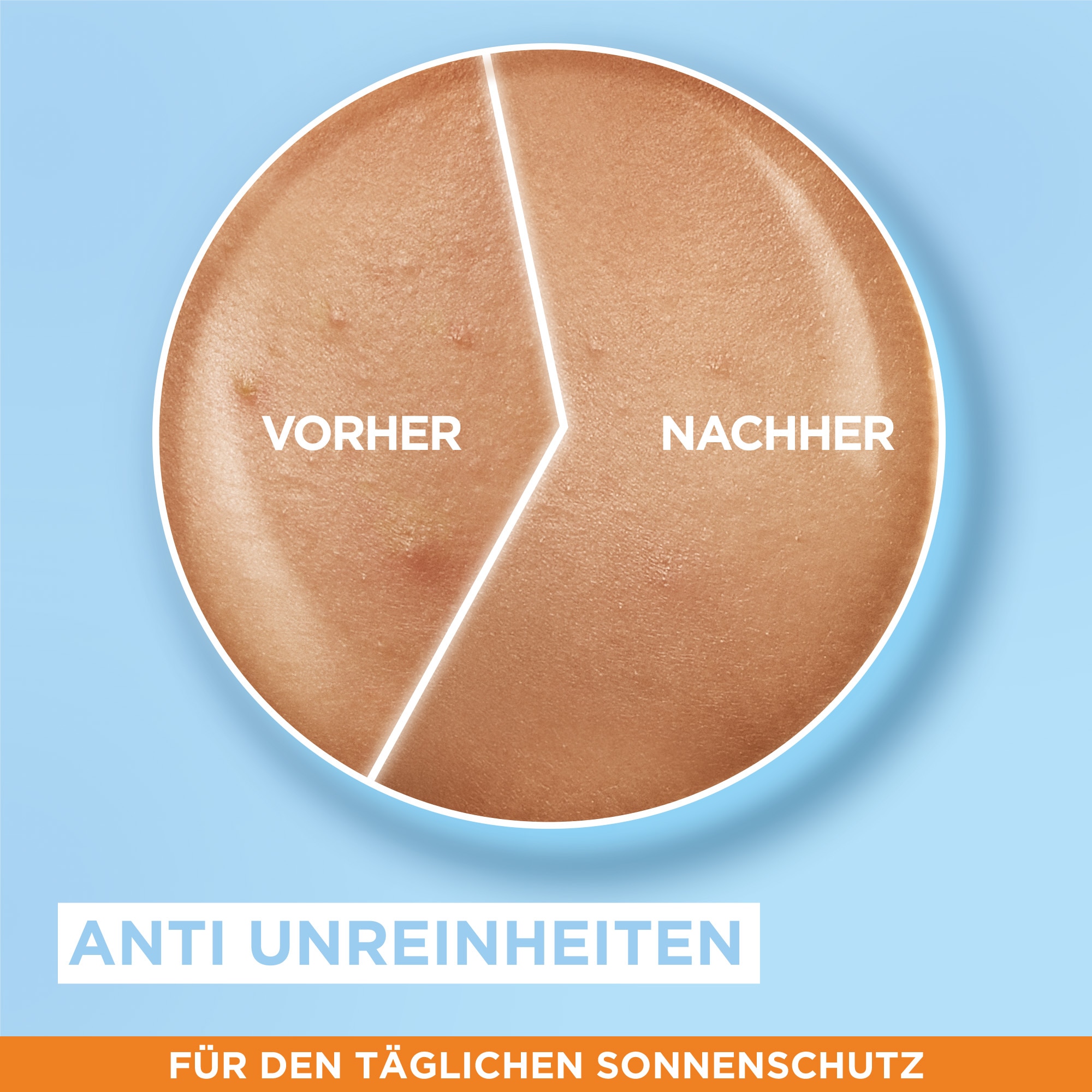 GARNIER Sonnenschutzfluid »Garnier Sonnenschutzfluid Niacinamid LSF50+«, mit Niacinamid und Zink