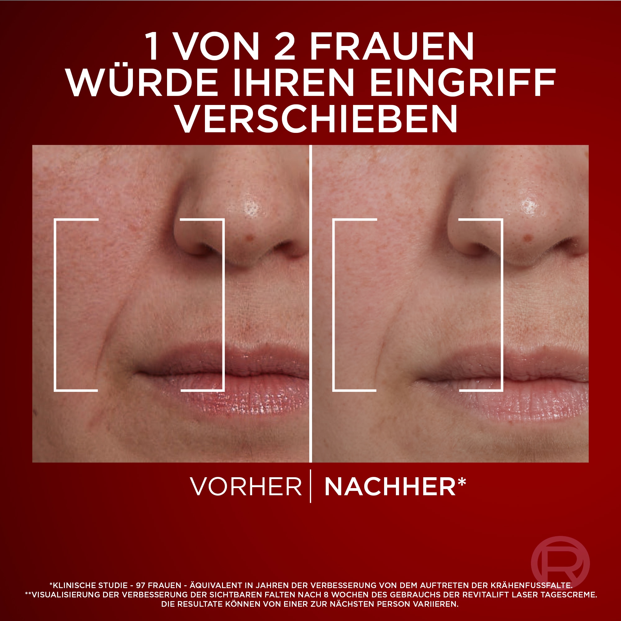 L'ORÉAL PARIS Nachtcreme »REVITALIFT LASER DREIFACH-POWER ANTI-AGE NACHTPFLEGE« mit Pro-Retinol + Hyaluronsäure und Vitamin C