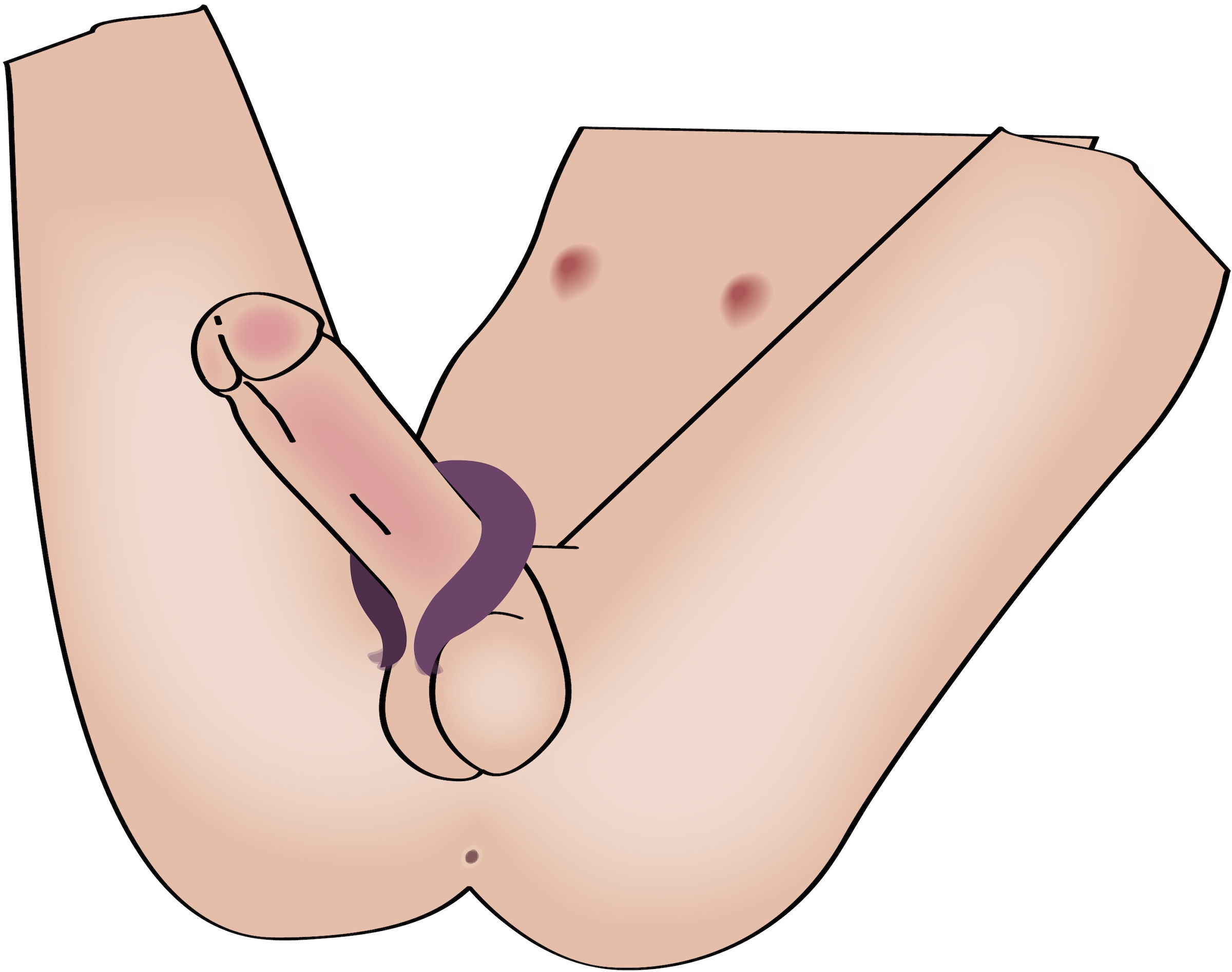 coup!es choice Vibrator »Penisring Two Motors couple¿s ring«