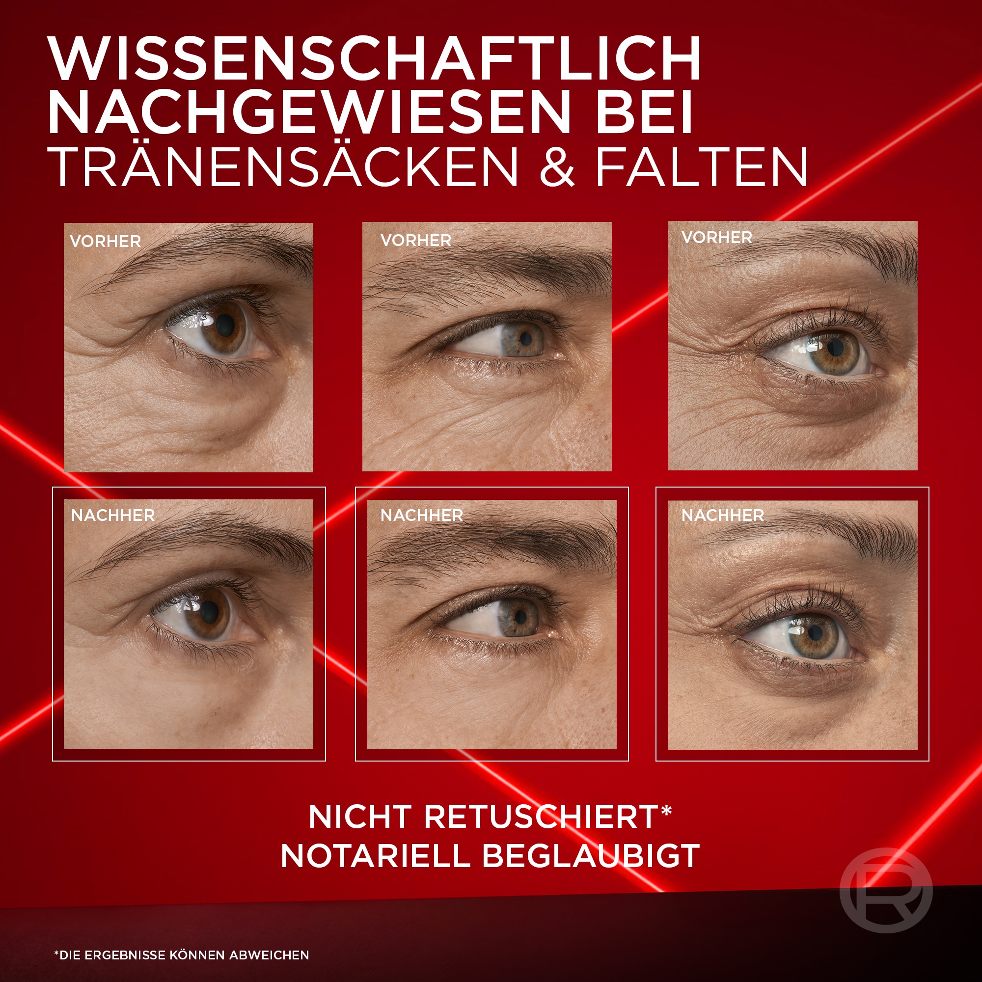 L'ORÉAL PARIS Anti-Aging-Augencreme »L'Oréal Paris Revitalift Laser Anti-Tränensack Sofort Lifting«